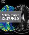 Cover of the journal "NeuroImage: Reports"